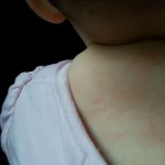 What should you do if your baby has a rash?